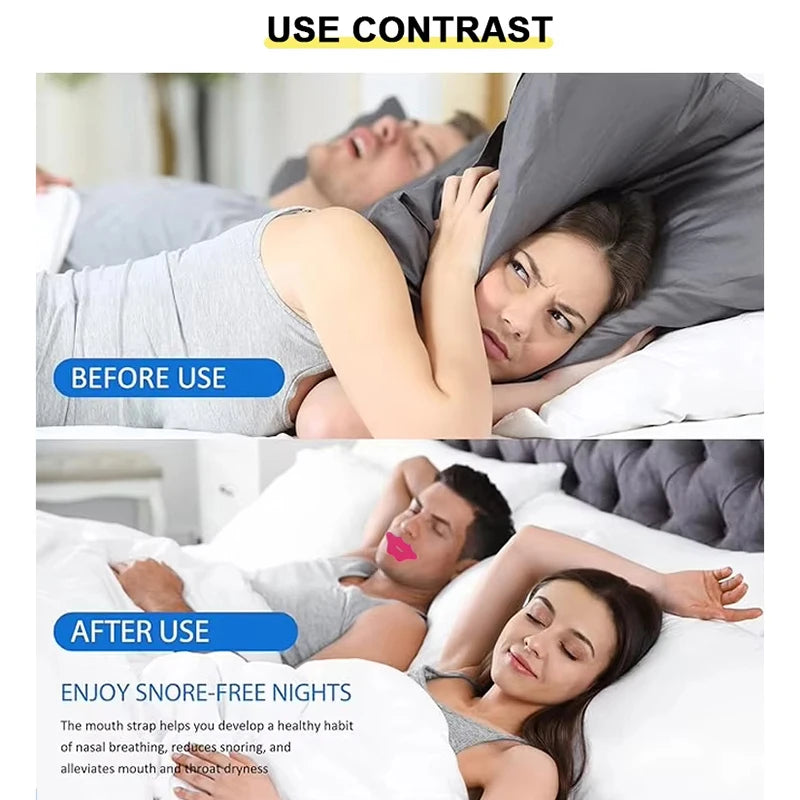 30pcs Mouth Tape For Sleep Apnea Mouth Tape Mouth Tape For Sleeping Snoring Mouth Breathing Tape Breathing Mouth Tape