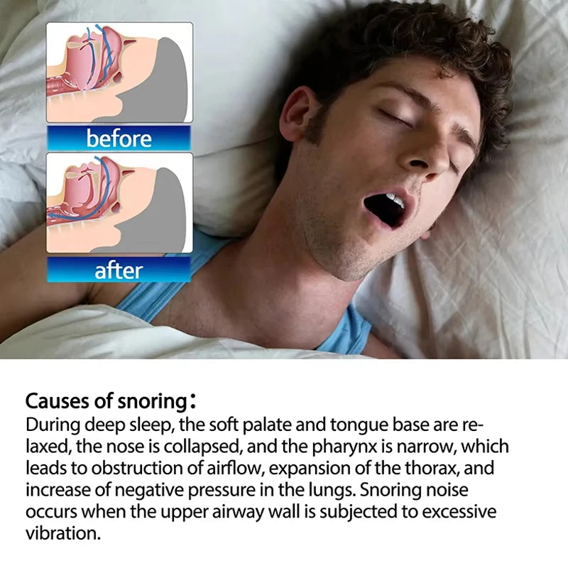 30pcs Mouth Tape For Sleep Apnea Mouth Tape Mouth Tape For Sleeping Snoring Mouth Breathing Tape Breathing Mouth Tape